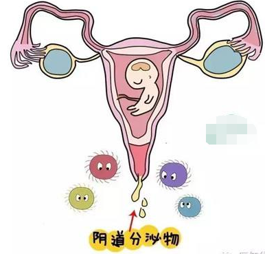 阴道分泌物香蕉视频下载地址的一般性状检查类型