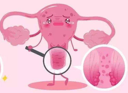 白带常规91香蕉视频色厂家提醒女士做好私密处清洗