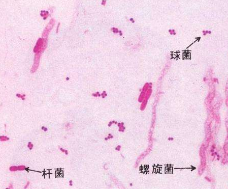 妇科白带香蕉视频下载地址厂家分析白带线索细胞阳性的意义